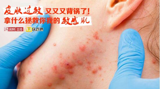 皮肤过敏又背锅了！拿什么拯救“敏感肌”