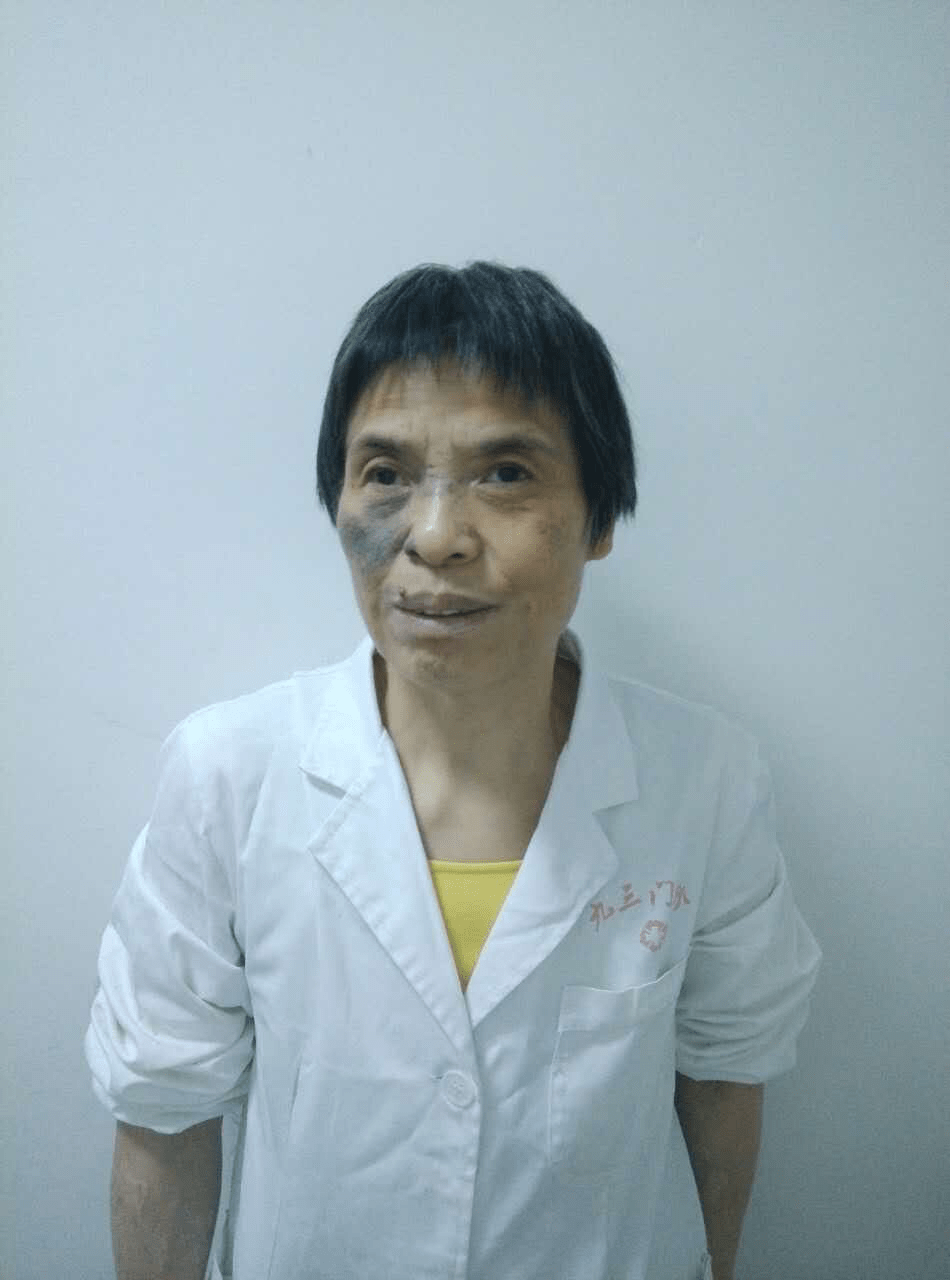 九三中医推拿科 王国娟